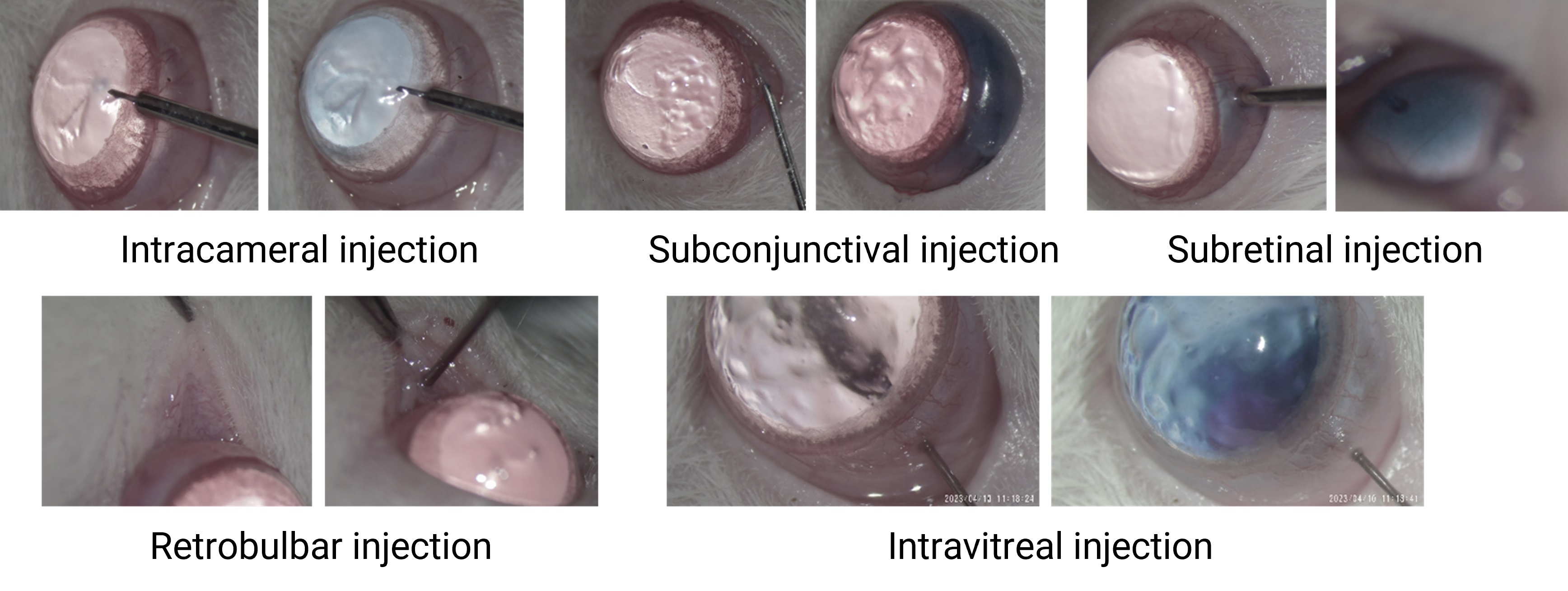 Multiple injection routes of drug administration in the eye