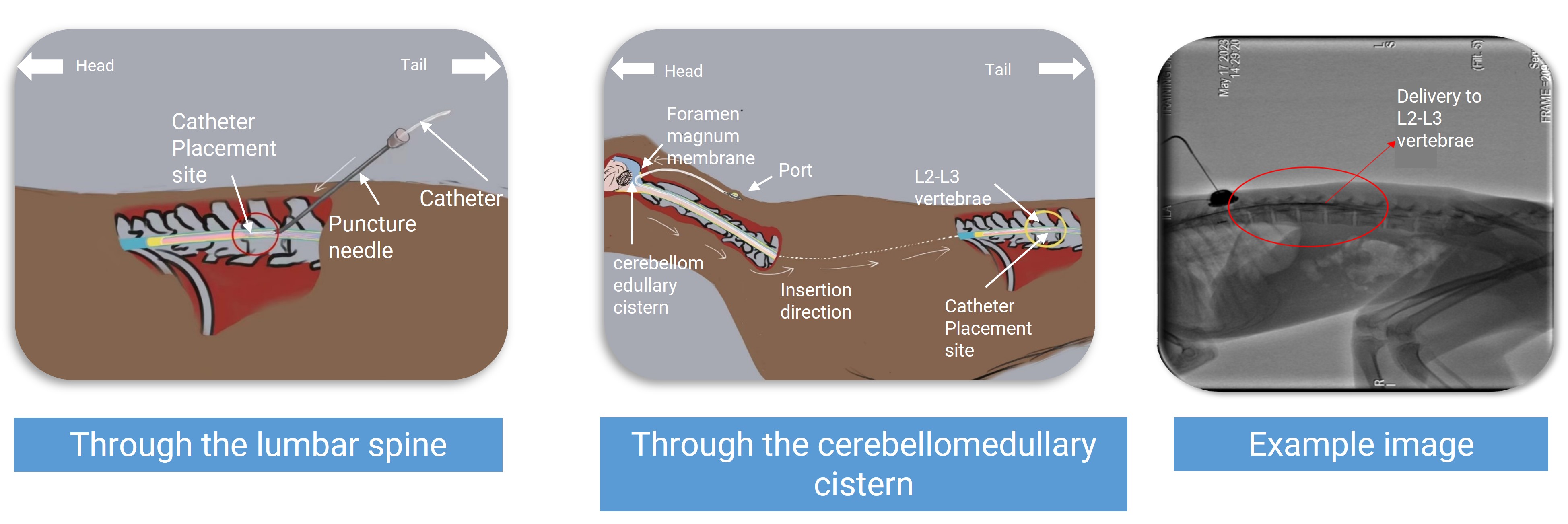 Two repeat intrathecal administration routes and an example image