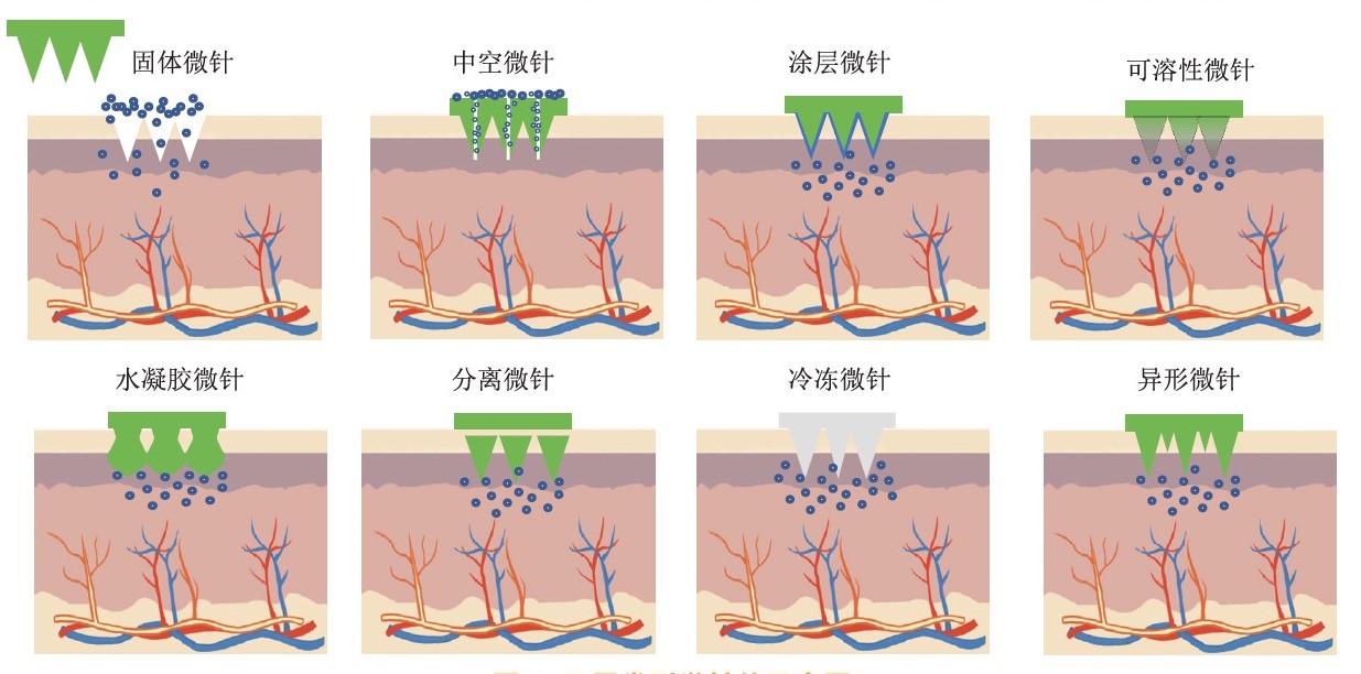 图2. 微针的类型.jpg