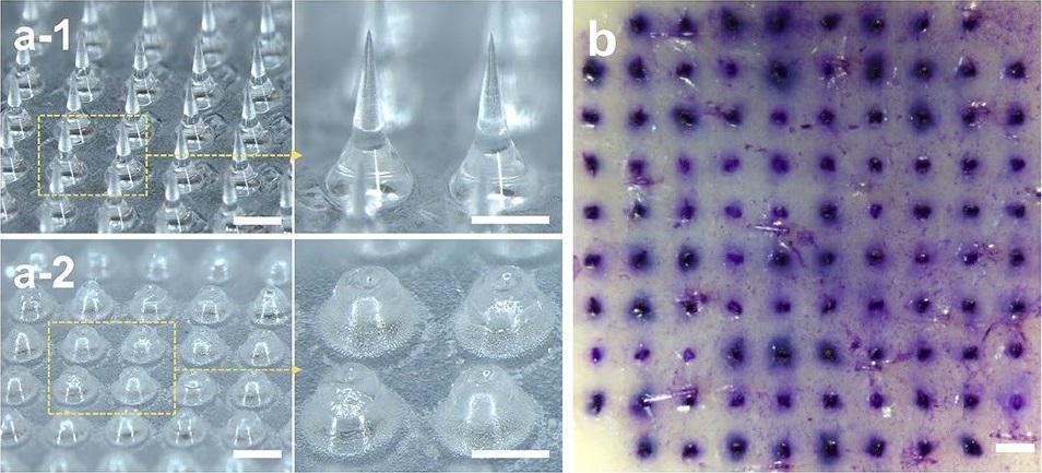 The morphology of dissolvable liraglutide microneedles before (a-1) and after (a-2) insertion into pig skin;

(b) Pig skin stained with 1% gentian violet solution after insertion