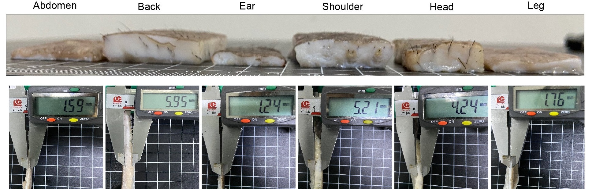The skin thickness of different sites