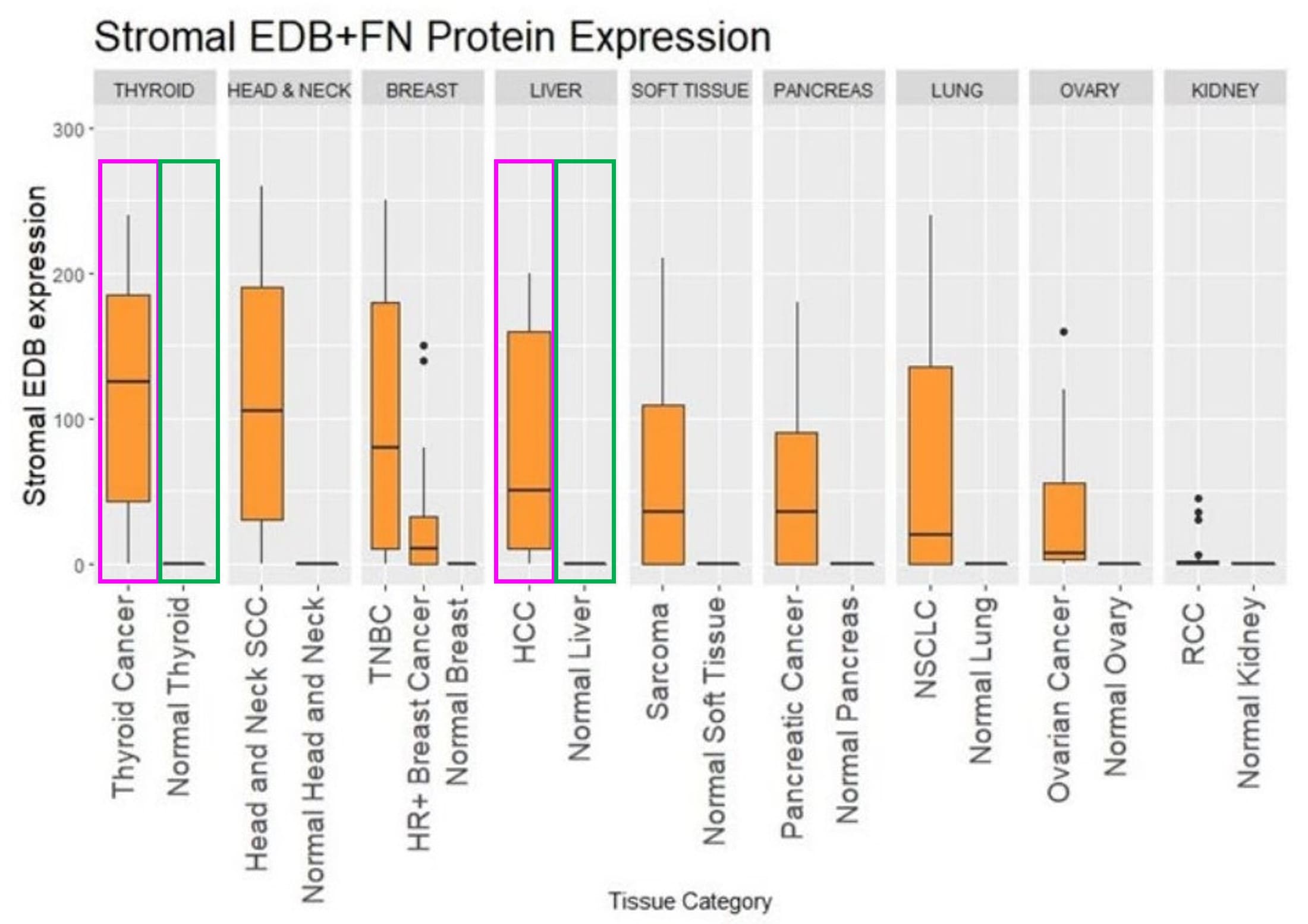 EDB+FN蛋白在肿瘤间质与正常组织中的表达差异