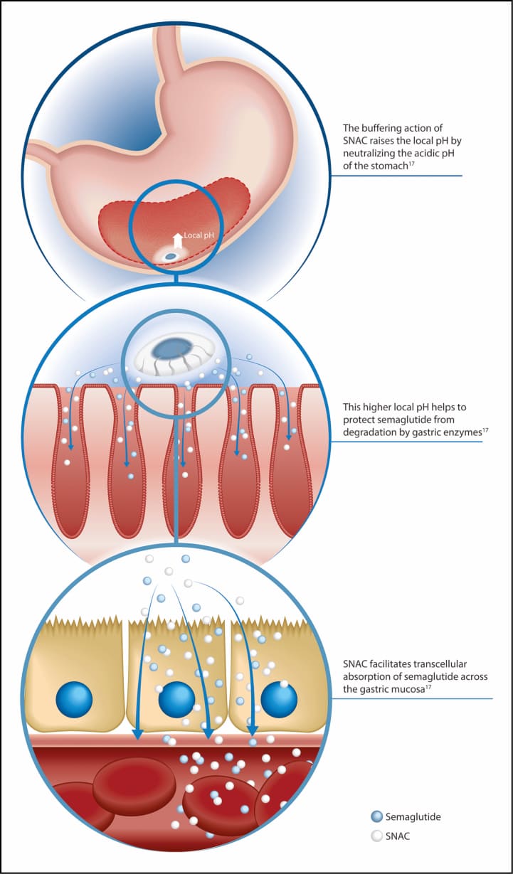 Mechanism diagram of SNAC promoting semaglutide absorption in the stomach