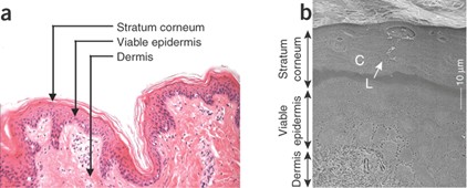 Histological structure of mammalian skin (a) Skin structure (Image of H&E stained porcine skin); (b) Stratum corneum structure (cryoscan electron microscopy image)