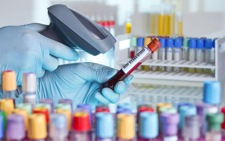 Transforming Blood Collection with Automated Blood Sampler (ABS) in Rats